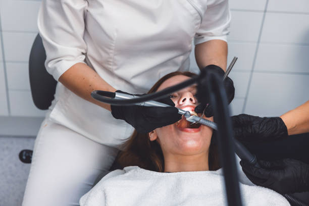 Best Emergency Wisdom Tooth Extraction in Broadmoor, CA